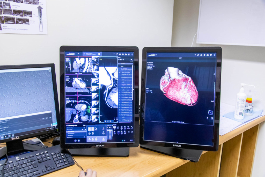 Cardiac Imaging