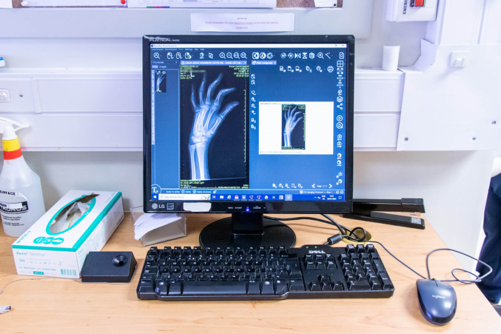 X-Rays