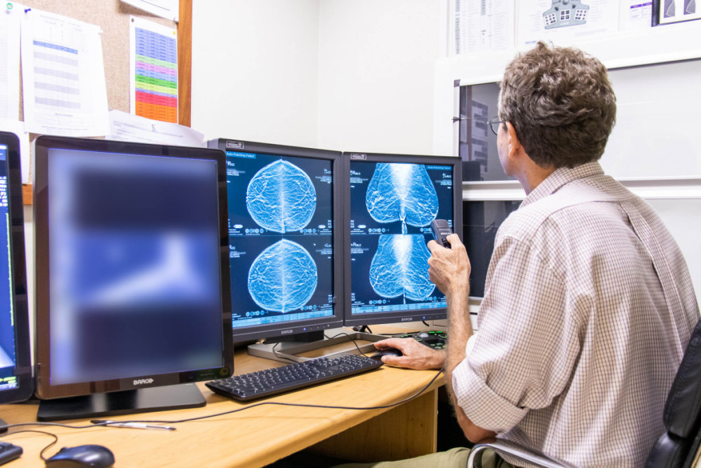 Mammography
