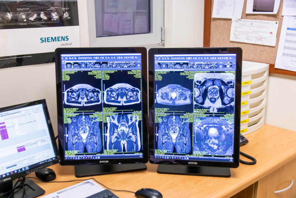 Magnetic Resonance Imaging (MRI)