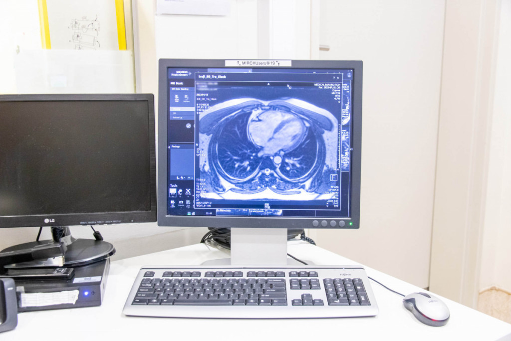 Cardiac Imaging