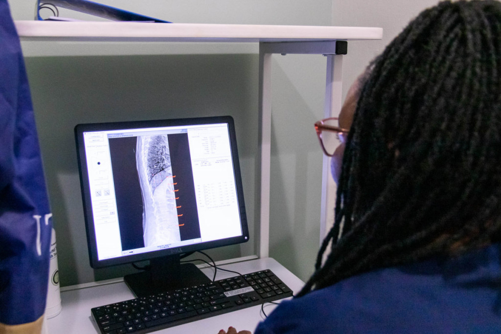 Bone Densitometry (DEXA)